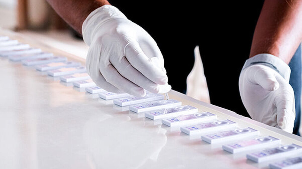 Einschränkung gelten womöglich für mindestens 43 Tests, die aufgrund ihres Testdesigns Schwierigkeiten beim Nachweis der Omikron-Variante haben könnten. Die Hersteller haben nun bis zum 13. April Zeit, um einen Beleg der uneingeschränkten Funktion na