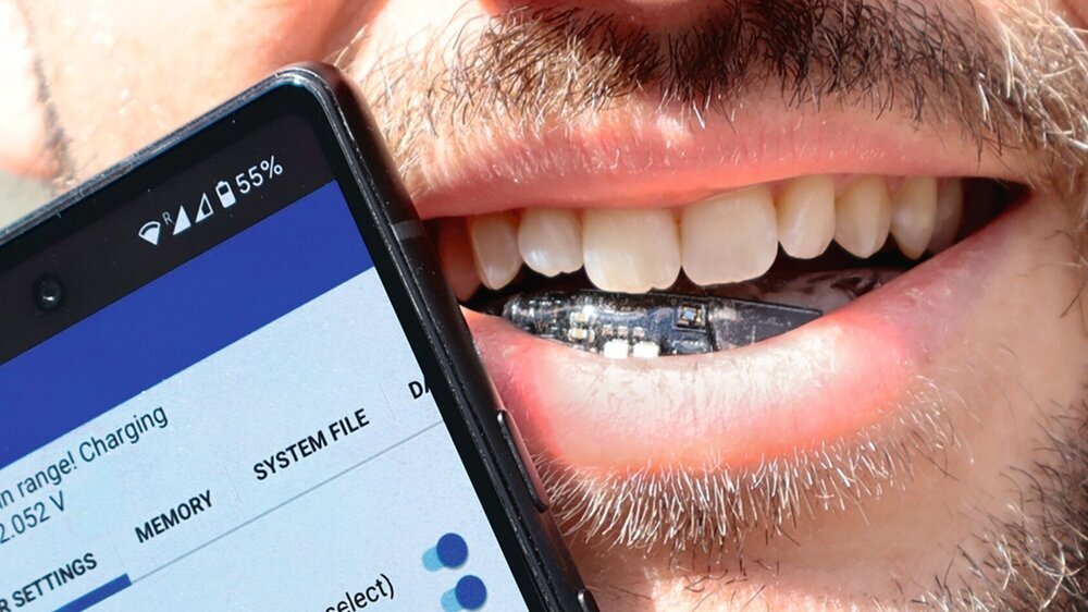 Batterielose Zahnspange