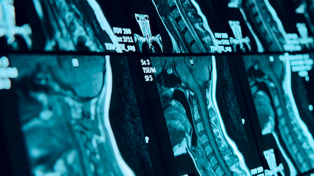 Adressaten der Leitlinie sind sind neben Radiologen, HNO-Ärzten, MKG-Chirurgen, Augenärzten, Neurochirurgen auch Zahnärzte.