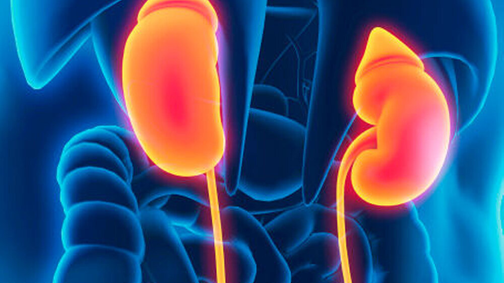 Eine Denervation der Nierenarterien lässt bei vielen ansonsten therapieresistenten Hypertonikern den Blutdruck sinken. |