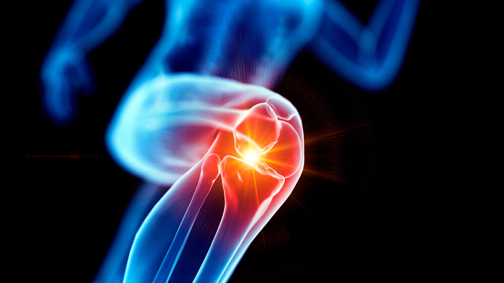 Rheumatoide Arthritis