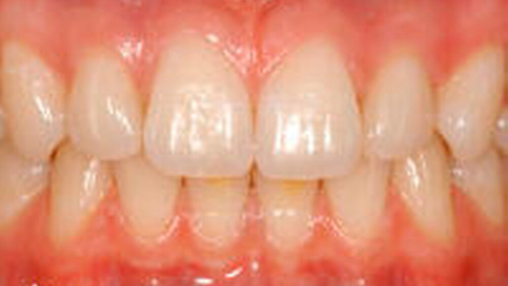 192914-flexible-1900 192914-flexible-1900