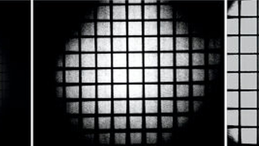 Abbildung 6: Die objektive Vermessung von zahnärztlichen Lupen an einer optischen Fachhochschule ergab große Unterschiede zwischen den einzelnen Lupen. Das gleiche Raster fotografiert durch eine Galilei-Lupe 2,5x (links) und zwei Kepler-Lupen 4,2x (Mitte und rechts). Zu beachten ist der Zusammenhang zwischen Arbeitsfeld und Vergrößerungsfaktor (links und rechts), aber auch der offensichtliche Qualitätsunterschied bei ähnlicher Vergrößerung (Mitte und rechts). Bei der Mehrheit der Lupen wurde eine Diskrepanz zwischen deklarierter und effektiver Vergrößerung gefunden [Neuhaus et al., 2013]. |