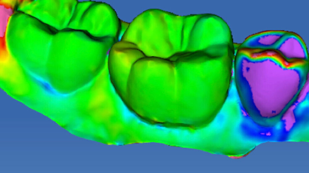 Der Praxispreis Dynamisches Digitales Modell ist mit insgesamt 9.000 Euro dotiert und wird auf der "Dentale SynOptic der AD DDM - Symposium der digitalen Zukunft“ in Berlin, 17. - 19. November 2022, verliehen.