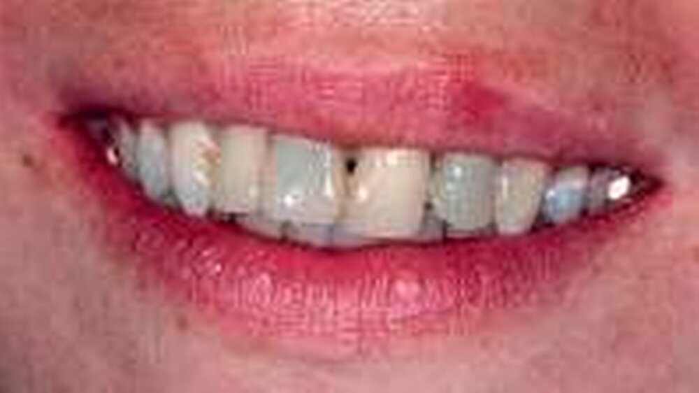 Abb. 1: Lippenbild bei Behandlungsbeginn