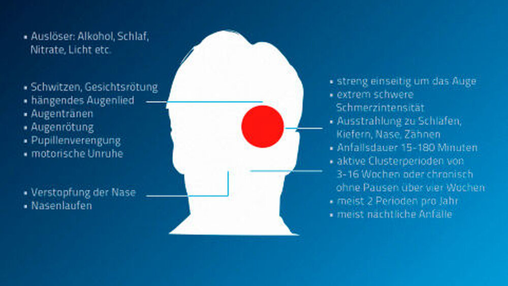 Der Clusterkopfschmerz weist ein charakteristisches klinisches Bild auf. |