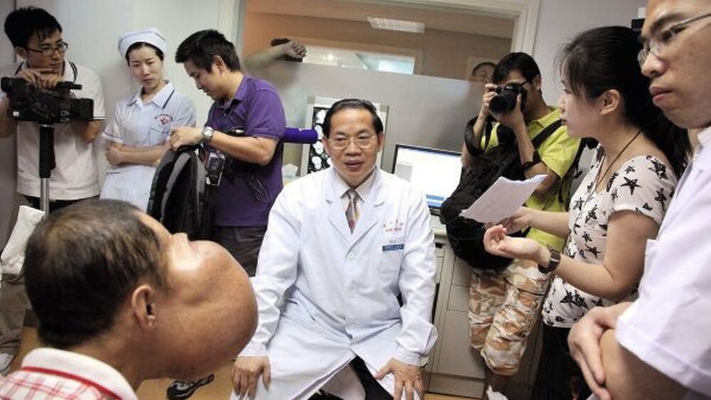 Die starken Deformationen im Gesichtsbereich machten den Patienten zum „Elefantenmann“. Einzelne Gewebepartien waren gesondert extrem gewachsen. |