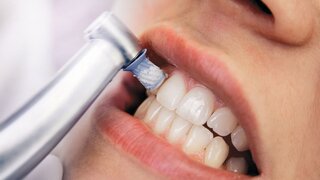 Close-up professionelle Zahnreinigung / die Zähne einer Frau werden poliert