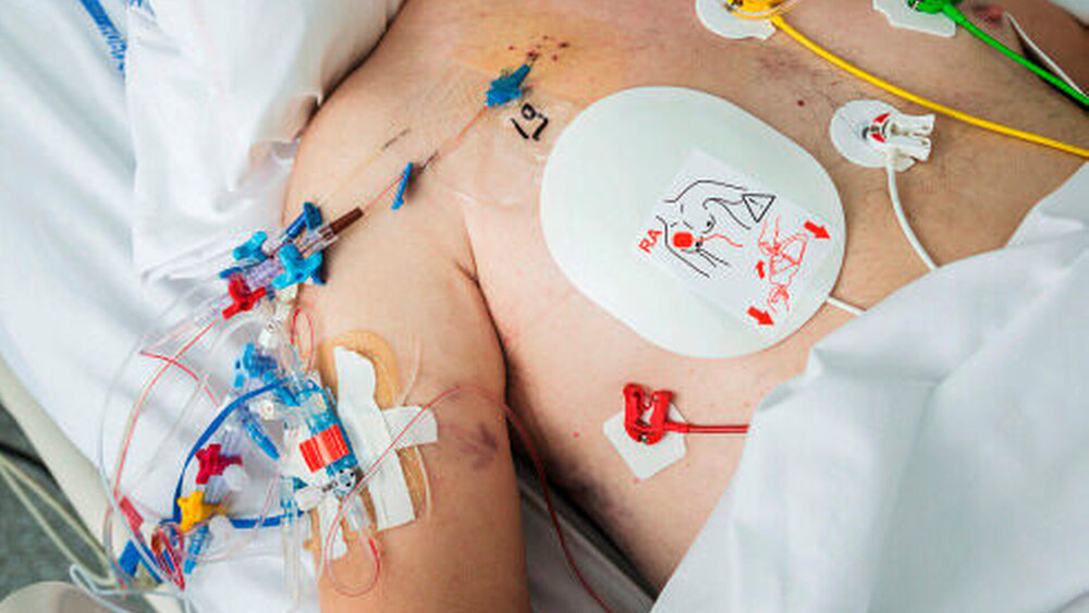 Das ACS entwickelt sich üblicherweise auf dem Boden einer ischämischen Herzerkrankung mit arteriosklerotischer Vorschädigung. Hier eine umfangreiche Herzuntersuchung. |