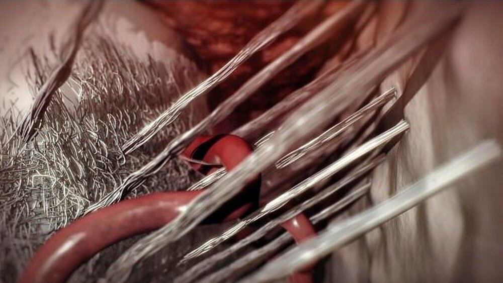 Abbildung 14: Filmszene: Darstellung der Regeneration des Desmodonts |
