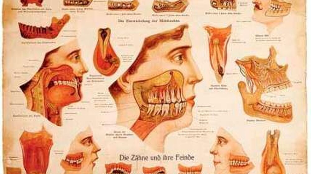 „Die Feinde der Zähne“ – Plakat um 1900