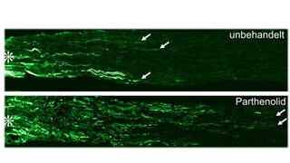Nervenregeneration