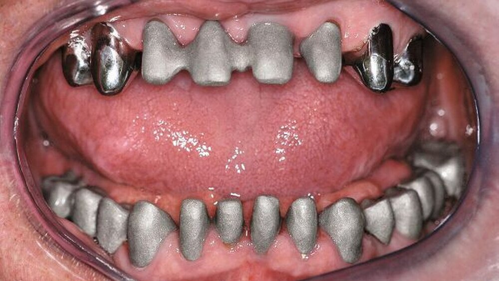 Abbildung 14: Gerüstanprobe. |