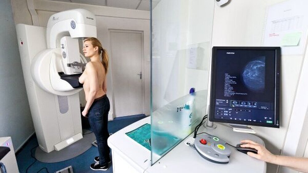 Das Brustkrebsscreening ist aus Expertensicht mitverantwortlich für die Rückläufige Sterblichkeit am Mammakarzinom,