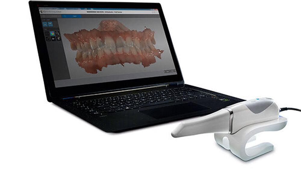 Einfach und universell einsetzbar avancierte der Intraoralscanner CS 3600 in den letzten Jahren zum Favoriten der Anwender.