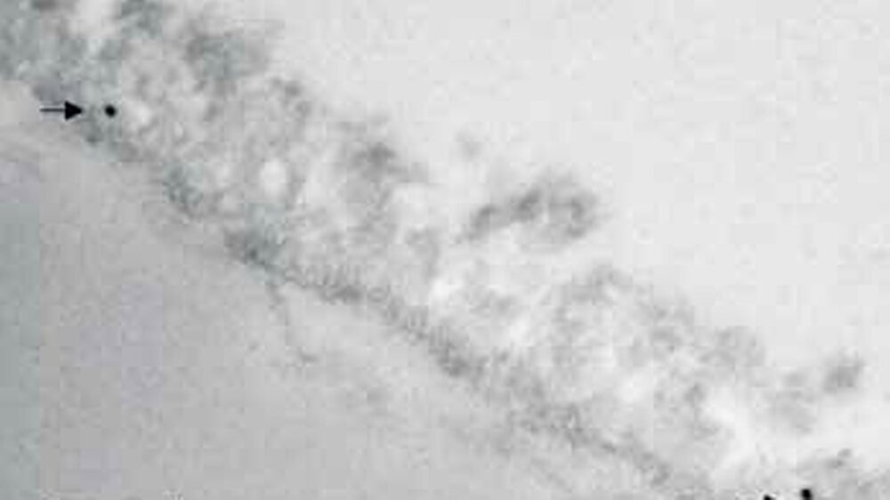 Abbildung 1: Markierung und Visualisierung von Peroxidasemolekülen in der Pellikel mit Hilfe der Gold-Immunolabellingtechnik, transmissionselektronenmikroskopische Aufnahme, 120 min, Pellikel buccal. Die Peroxidasemoleküle (Pfeil) finden sich in allen S