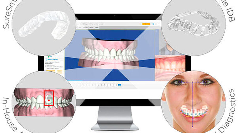 Umfangreiche Behandlungsoptionen und Flexibilität in der Umsetzung – das ist SureSmile.