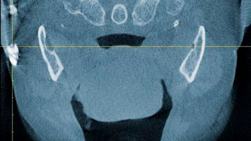 Abbildung 3: DVT-Ansicht in axialer Richtung |