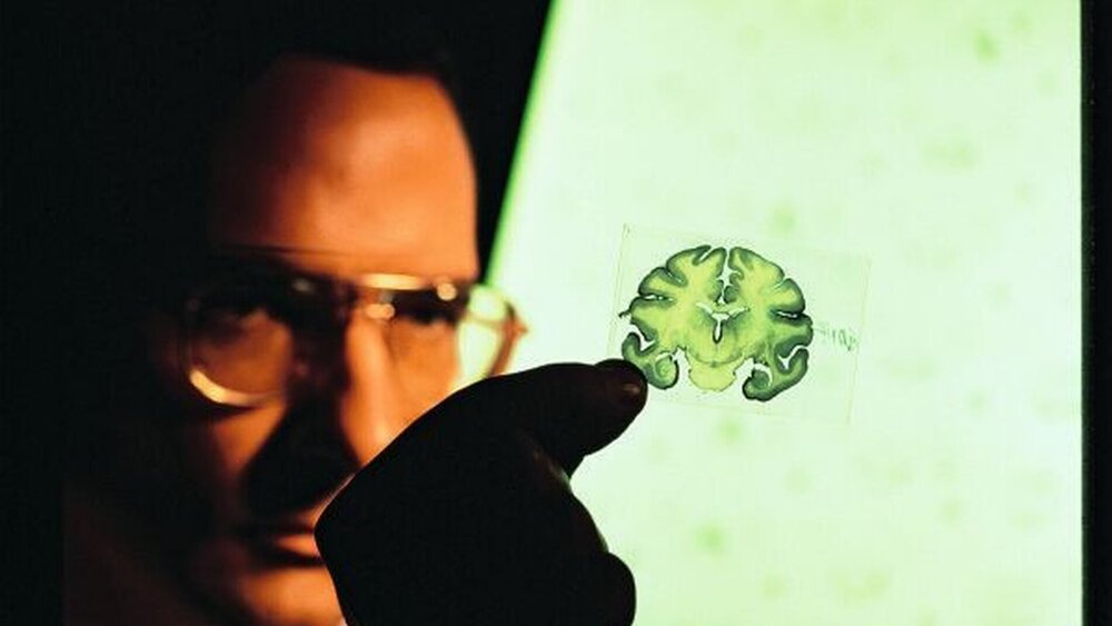 Neurodegenerative Erkrankungen sind einer der aktuellen Forschungsschwerpunkte. |