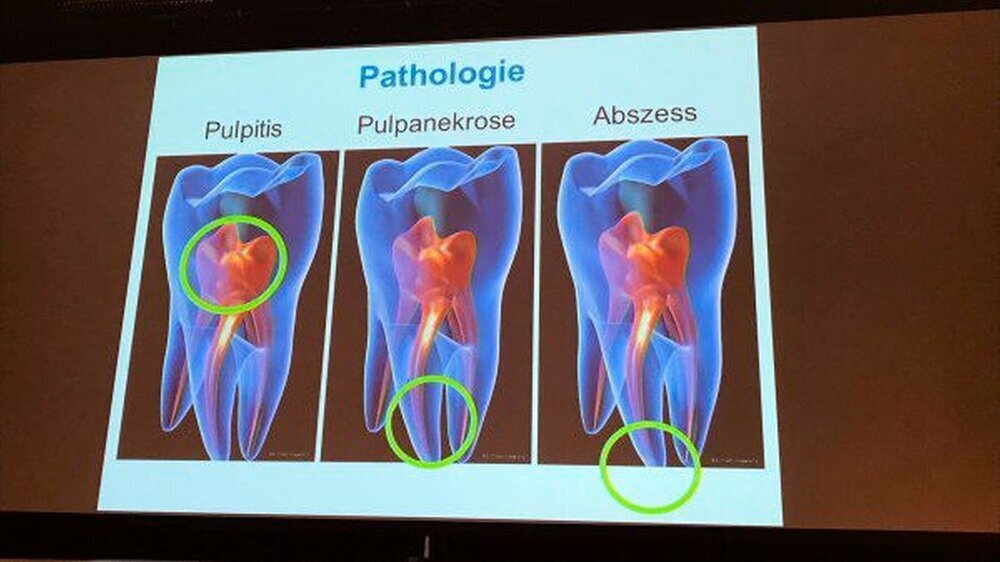 Über 20 namhafte Referenten stellten ihre Arbeit in ihren Vorträgen vor und vertieften die Inhalte in ihren Seminaren. Die Deutsche Gesellschaft für Endodontologie und zahnärztliche Traumatologie hatte zusammen mit dem Fortbildungsreferenten der Kamm