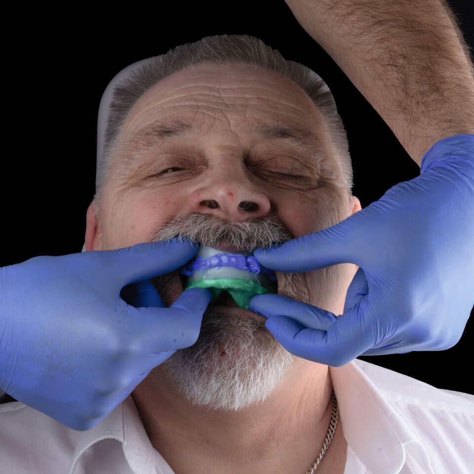 Denture adjustment
