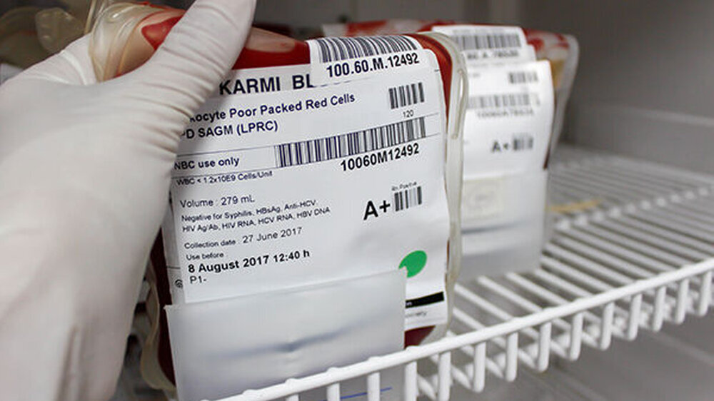 Anfang Juni hatten Forscher aus Kiel und Oslo in einem Preprint berichtet, dass Menschen mit der Blutgruppe A ein höheres Risiko für einen schweren COVID-19-Verlauf haben. Die Untersuchung bestätigte seinerzeit Analysen aus China und den USA. Die US-Fo