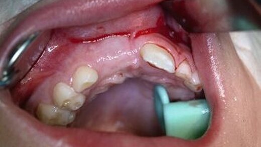 258993-flexible-1900 258993-flexible-1900