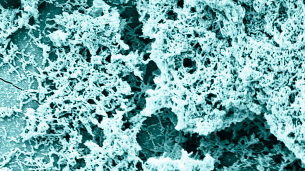 Abbildung 1: Streptococcus mutans Biofilm auf Zahnschmelz |