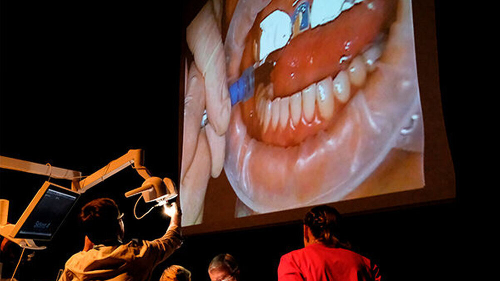 Höhepunkt des CEREC Masterkurses in Leipzig im Vorjahr war eine Live-Behandlung, bei der ZA Peter Neumann die Stiftversorgung eines endodontisch behandelten Zahns vornahm.