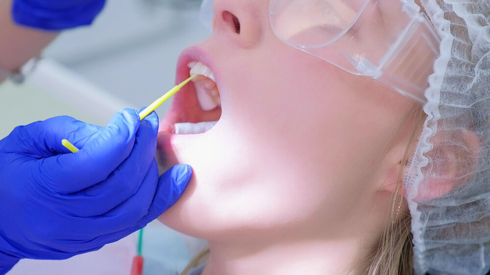 Fluoridierung von Zähnen