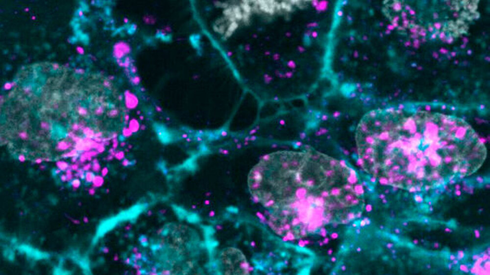 Zellen im Labor kultivierter, menschlicher Spenderhäute (grau und cyan) werden durch die Aufnahme künstlicher Exosome (lila) beeinflusst.