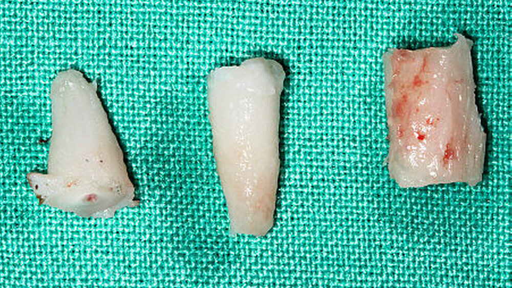 Abbildung 1a: Makroskopische Gegenüberstellung von extrahierten/separierten Zahnwurzeln und einem kortikalen Knochenblock (rechts) (Tiermodell). |