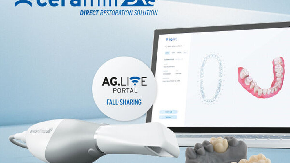 Ceramill Direct Restoration Solution (DRS).