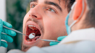 Zahnarzt untersucht Mundhöhle mit Spiegel