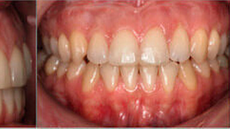 Abbildung 8a: Befund etwa 1,5 Jahre nach der Behandlung |