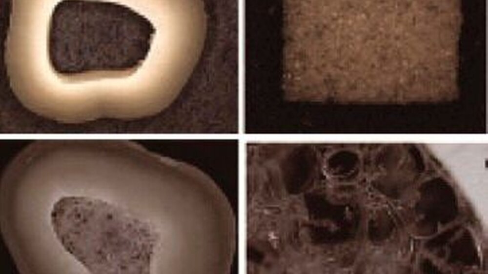 Abbildung 1: Tissue Engineering der dentalen Pulpa. A: Zahnscheibe und Trägermaterial aus PLLA. Das Scaffold (Trägermaterial) wird zugeschnitten und in die Pulpakammer eingebracht. Auf das poröse Material werden anschließend die Zellen gesät.