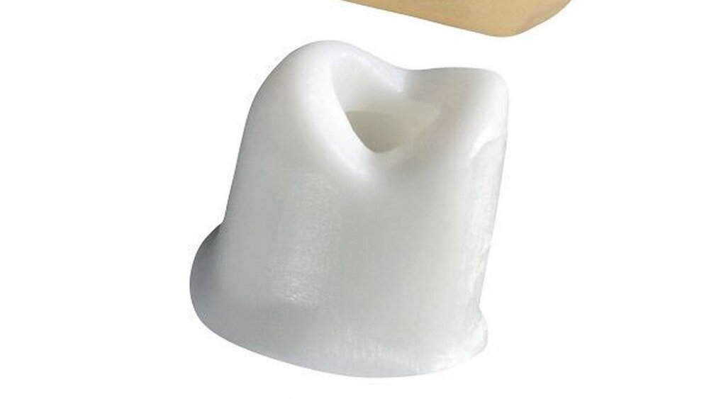 Abbildung 1: Die Titanhülse stabilisiert das ZrO2-Abutment und vermeidet Zugspannung bei Verschraubung. |