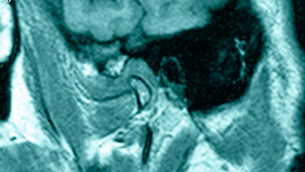 Abbildung 8: Magnetresonanztomografie, transversale Schnittebene |