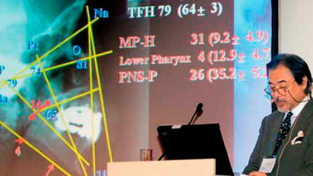 Priv. Doz. Dr. Makoto Kikuchi, Tokio, erklärt den Zusammenhang zwischen dem Gesichtsschädelaufbau und dem Symptom einer Schlafapnoe.