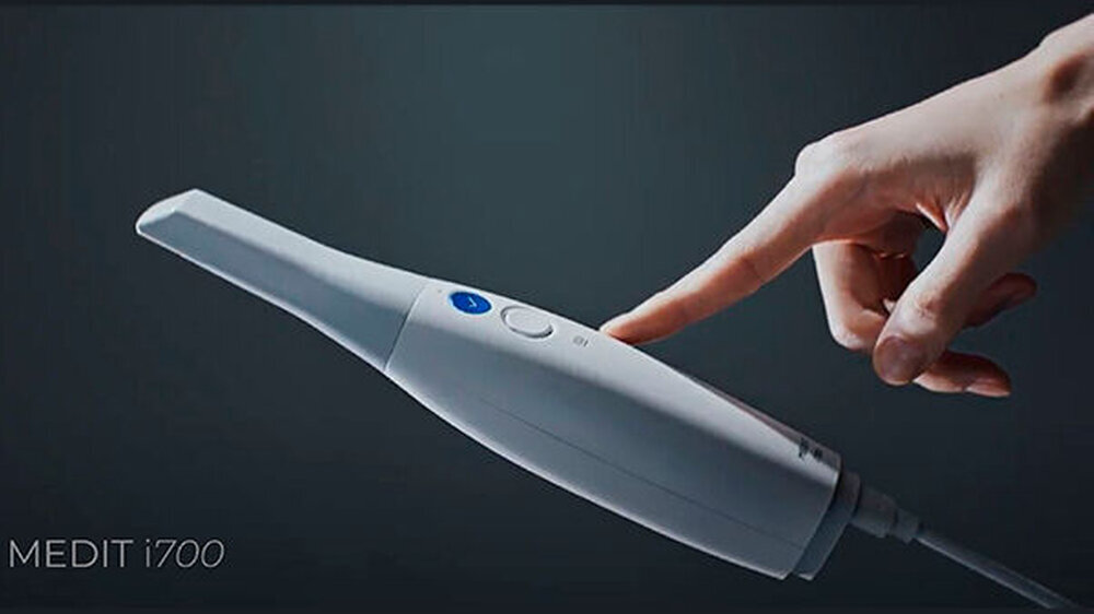 Der neue leistungsstarke Intraoralscanner Medit i7OO.