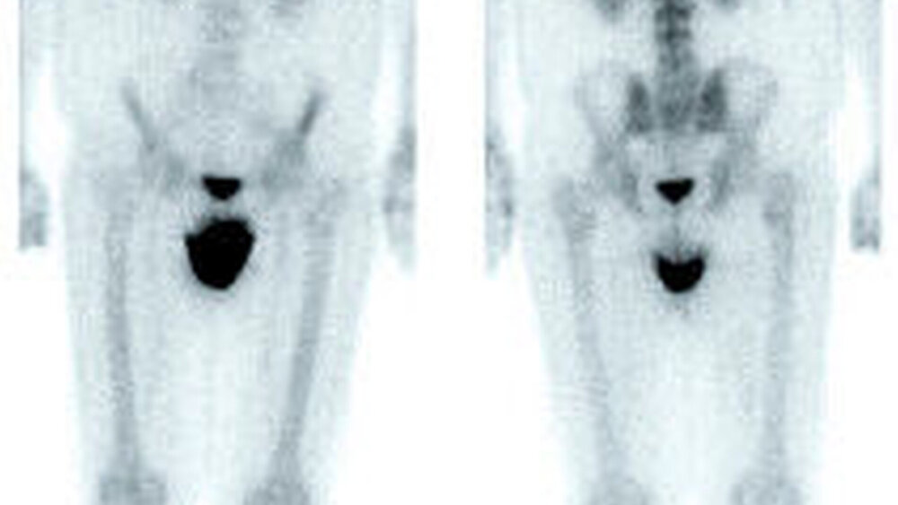 Abbildung 6: Gleicher Patient von Abbildung 5 |