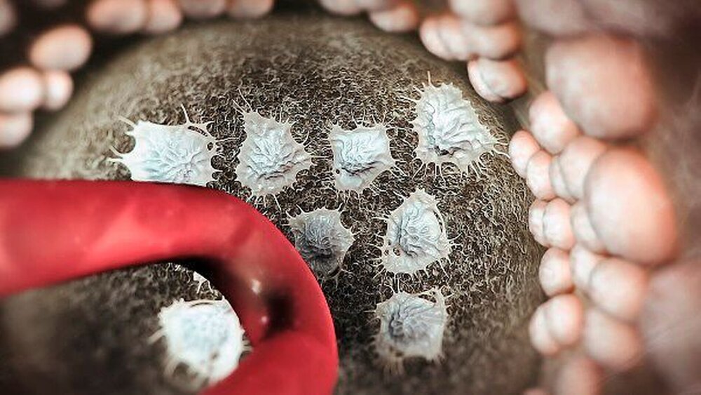 Abbildung 12: Cutting Cone mit zentralem Blutgefäß, Osteklasten (Mitte) und Osteoblasten (randständig) |