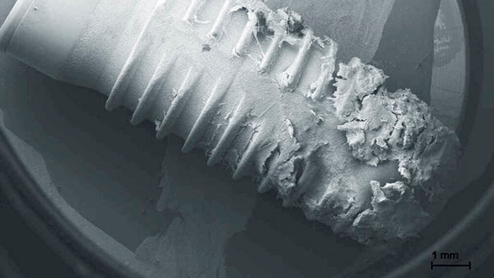 Abbildung 1: Rasterelektronenmikroskopische Aufnahme eines von Periimplantitis betroffenen und explantierten zahnärztlichen Implantats mit dichtem Biofilmwachstum – eine Herausforderung für heutige Therapieansätze