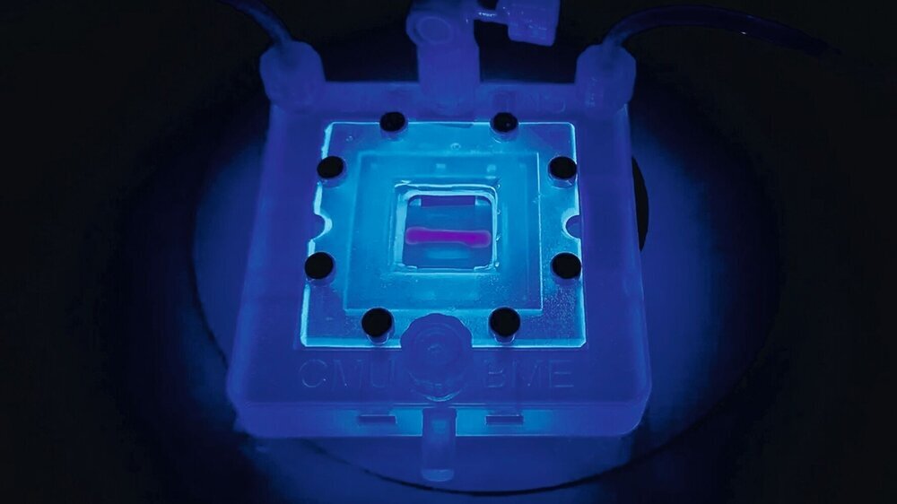 3-D-Druck lebender Zellen: Hilfe für Diabetes-Patienten