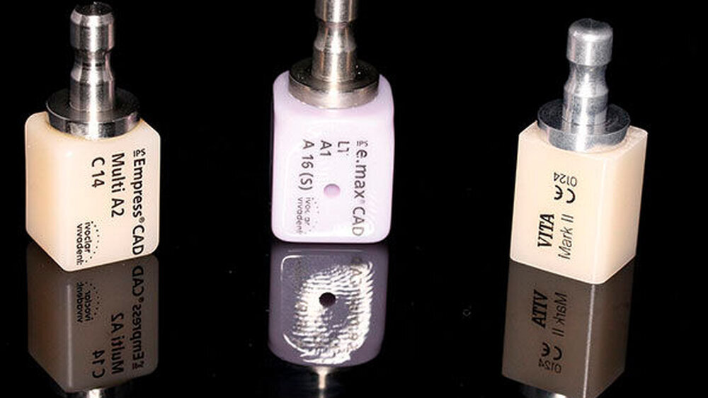 Abbildung 3: Keramikrohlinge für die CAD/CAM-Fertigung (Mitte: Rohling mit vorgefertigter Adaption an ein Abutment im vorkristallisierten („blauen“) Zustand)\r\n