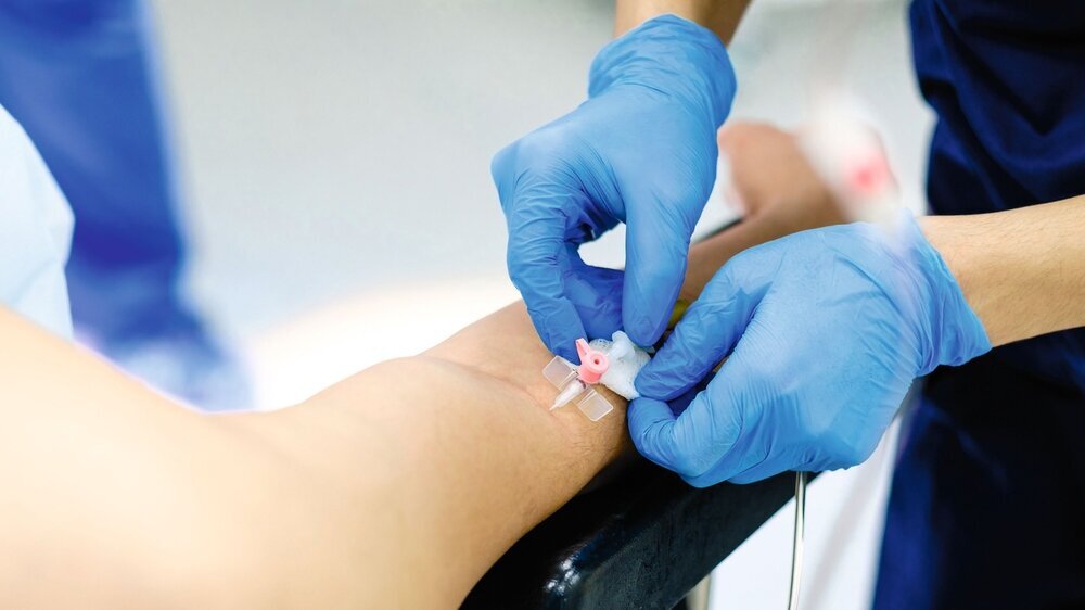 A doctor in sterile gloves inserts a catheter needle into the patient's arm. intravenöse Sedierung