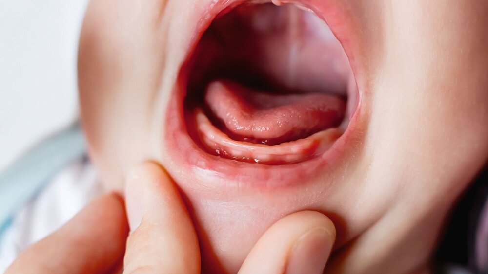 Close up photo of crying 3 months old baby mouth. Bare gums without teeth.