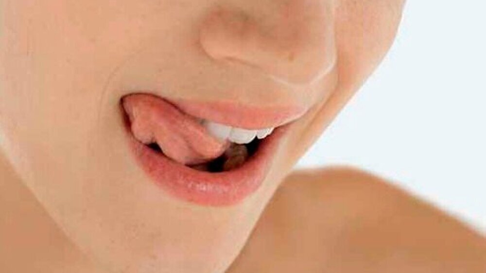 Ein ständig trockener Mund und eine damit verbundene raue Zunge – bei Xerostomie sollten die Ursachen ermittelt werden.