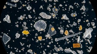 Mikroplastik unter dem Mikroskop, KI-Generiert