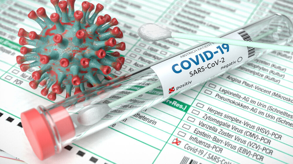 Eineinhalb Jahre nach Pandemiebeginn beruhen die Informationen zu den Infektionen in Deutschland immer noch größtenteils auf den bei den Gesundheitsbehörden gemeldeten COVID-Fällen. Die zahlreichen seroepidemiologischen Studien in Deutschland fokussie